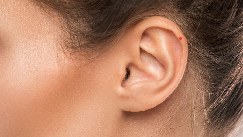 Nốt ruồi son nằm trên vành tai 